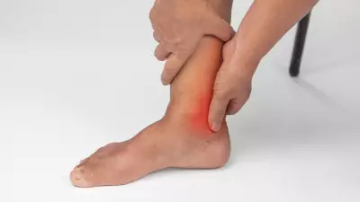 Subtle Signs of High Uric Acid You Shouldn't Ignore Without Gout