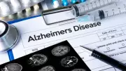 Alzheimer's Disease Myths Debunked: Expert Insights on Dementia