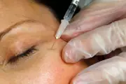 Botulinum Toxin's Journey from Medical Treatment to Cosmetic Use