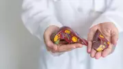 Fatty Liver Can Be Reversed with Weight Loss: Expert Explains How