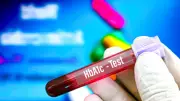 Iron Deficiency Anemia Can Falsely Elevate HbA1c, Leading to Wrong Diabetes Diagnosis