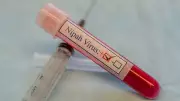 Kerala Nipah Patient Critical, No New Cases Reported