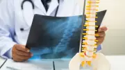 Rare Simultaneous Motion-Preserving Spine Surgery Restores Patient's Mobility