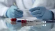 Second Sudanese National with Fever Admitted to Hyderabad's Gandhi Hospital for Ebola Screening