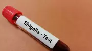Shigella Cases Rise in Kerala's Wayanad: 16 Children Infected Amid West Nile Scare