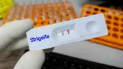 Shigella Infection: Kerala Toddler Dies, Know Symptoms and Prevention
