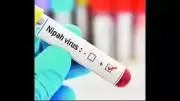 Suspected Nipah Case in Kozhikode: Patient Hospitalized, Tests Await Confirmation
