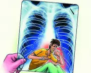 Telangana Intensifies TB Screening in 2,492 Villages