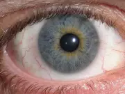 Why Human Eyes Have White Sclera: Communication and Evolution