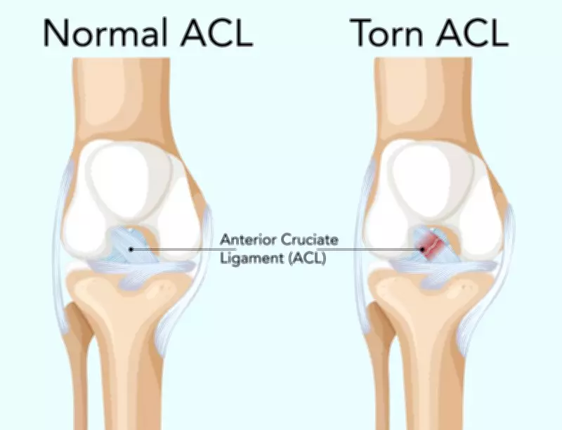 DoctorSpeak: All About Knee Injuries – Causes, Symptoms, and Recovery