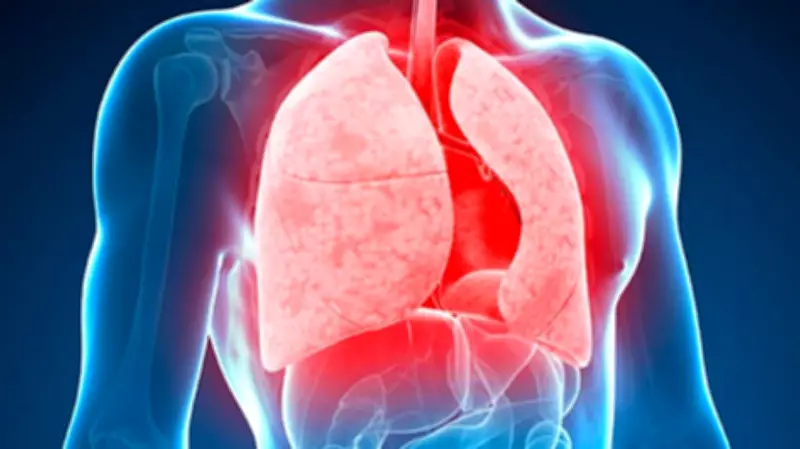Karnataka halves TB death rate, improves treatment success: Report
