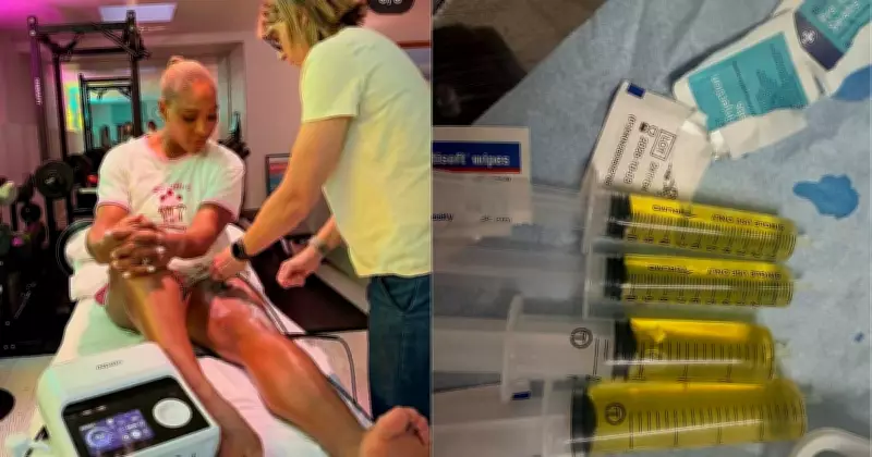 Knee Effusion Forced Serena Williams to Withdraw from Wimbledon 2026