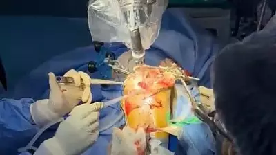 KMCRI Performs First Robotic Arthroplasty, First Govt Hospital in Karnataka