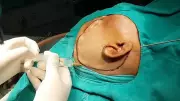 KMCRI Hubballi performs rare skull base surgeries on 70 patients