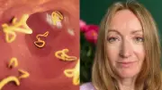 UK woman claims Indian food gave her brain parasites, sparks health debate
